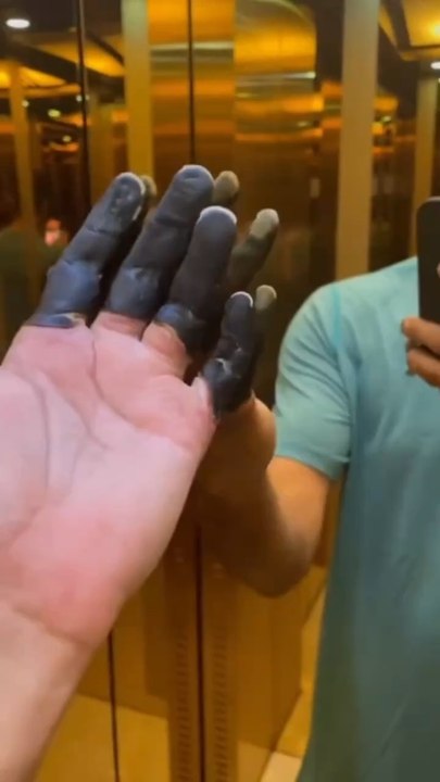 Ses doigts deviennent noires