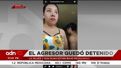 Una mujer ayuda a un niño de cuatro años que fue atropellado por un camión I Ciudad Desnuda