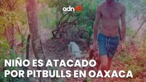 Un niño fue atacado por pitbulls y se debate entre la vida y la muerte en oaxaca