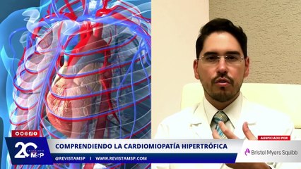 Comprendiendo la cardiomiopatía hipertrófica: ¿Qué puede provocar? - #MSP