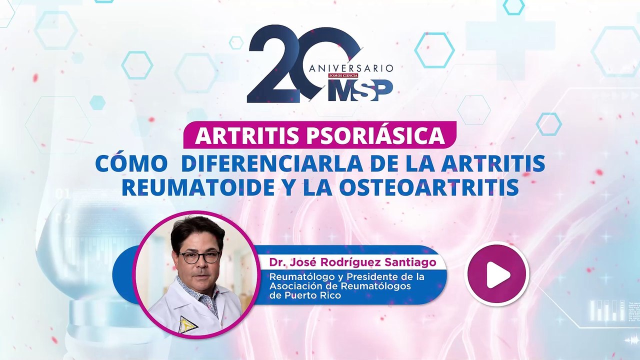 Artritis psoriásica: ¿Cómo diferenciarla de los otros tipos de artritis? -#ExclusivoMSP