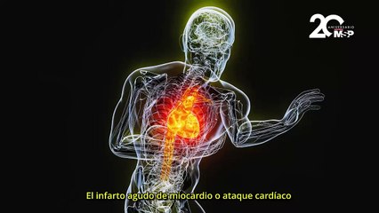 Ataque al corazón: los síntomas del infarto según el género - #ExclusivoMSP