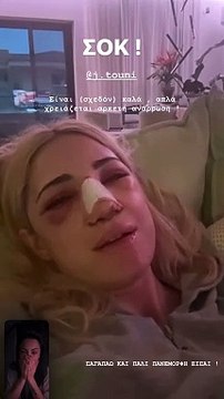 Ιωάννα Τούνη: Σοκαρίστηκε η Δήμητρα Αλεξανδράκη όταν είδε τη φίλη της μετά την επέμβαση στη μύτη