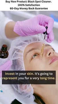 HOW TO GET RID OF DARK SPOTS | SKINCARE TIPS | ANTI AGING SKINCARE | BEAUTY TIPS