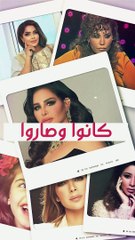 إيلاف الزهراني تكشف عن خضوعها للتجميل بعد تعرضها للتنمر