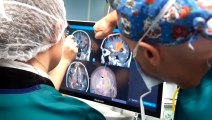 Cremona, tumore al cervello operato con la chirurgia transulcale mininvasiva: ecco perch? ? rivoluzionaria