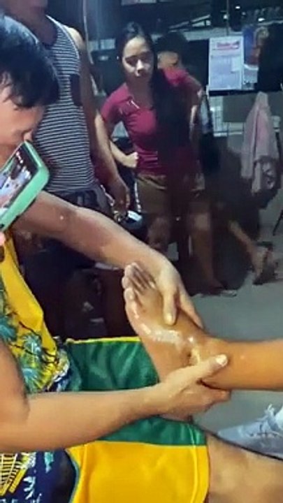 paano iaayos ang nalisyang buto sa Paa