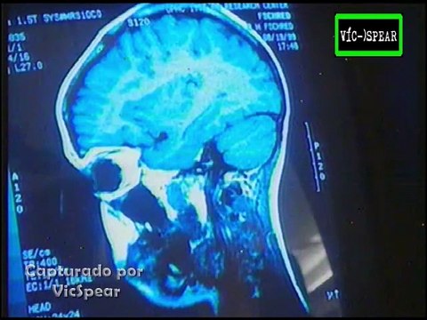 La Historia del Cerebro: Desarrollo Mental - Documental (2000) - Español Latino - Episodio 5