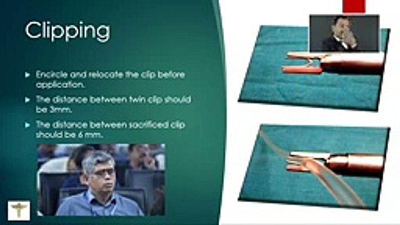 Understanding Laparoscopic Cervical Cerclage_ A Step-by-Step Guide (64 kbps) (1)