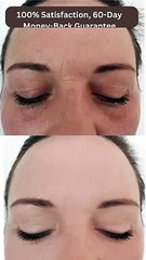 Get Wrinkle less Face | Skincare products | Natural Skincare