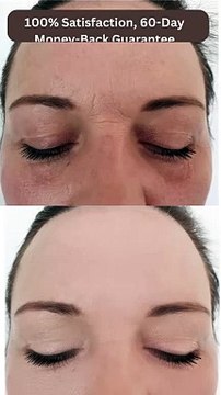 Get Wrinkle less Face | Skincare products | Natural Skincare