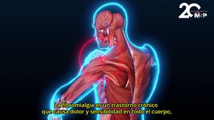 Neuromodulación: una alternativa para tratar el dolor de la fibromialgia - #EspecialMSP