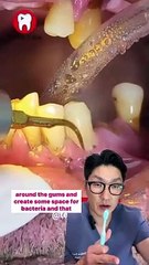 Understanding Periodontal Disease: Insights from Riverside Dentist Dr. Andrew Choi