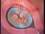 ABORTO NO GRAZIE - GIULIANO FERRARA spot - moratoria sulla