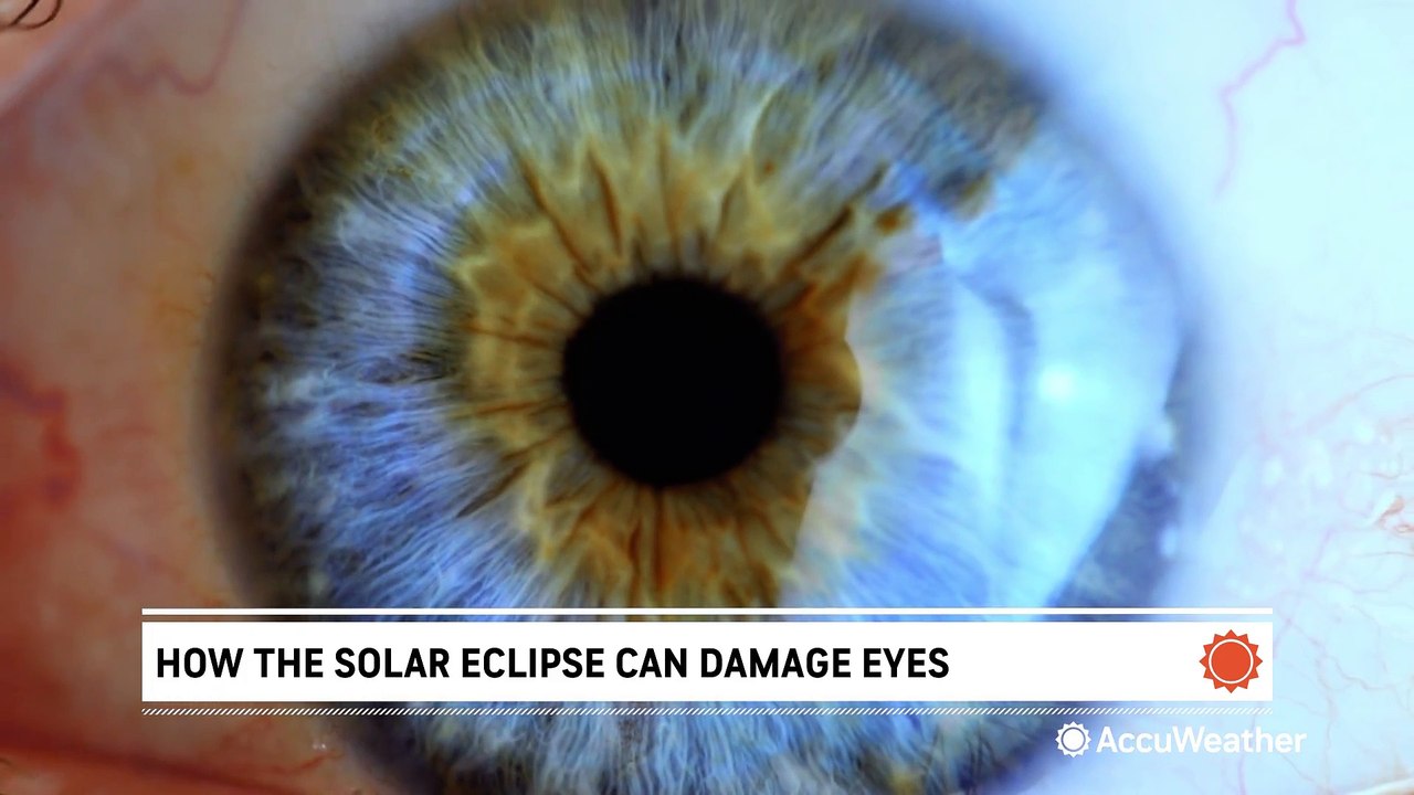 How the solar eclipse can damage unprotected eyes