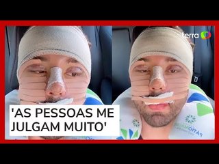 Rico Melquíades explica que fez cirurgia no rosto por 'não aguentar mais ser chamado de feio'