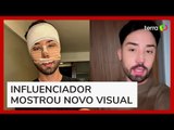 Rico Melquiades revela como ficou após passar por cirurgias plásticas no rosto