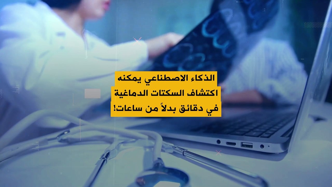 الذكاء الاصطناعي يمكنه قراءة فحوصات الدماغ تلقائياً.. واكتشاف السكتات الدماغية بدقائق فقط!
