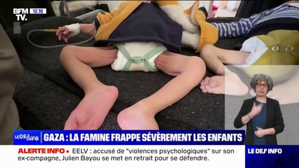 Des enfants meurent de faim dans les hôpitaux de la bande de Gaza