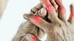 10 Lesser Known Rheumatoid Arthritis Symptoms  #rheumatoidarthritis #symptoms #treatment #beauty