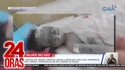 24 Oras Part 3: Batang nilapa ng 4 na aso; pamilyang nakatira sa kweba; Megan Young, nag-sorry; paglilinaw ni Rio Locsin sa nag-viral na pag-iyak sa set ng "Black Rider", atbp.