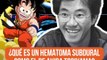 ¿Qué es un hematoma subdural como el que causó la muerte de Akira Toriyama, creador de Dragon Ball?.