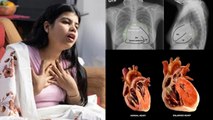 Heart Enlargement Symptoms: Dil Badha Hone Ke Lakshan | दिल का बड़ा होना कौनसी बीमारी | Boldsky