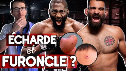 L'ÉCHARDE DE CÉDRIC DOUMBÉ ET LE BOUTON DE BENOÎT SAINT DENIS : DE QUI SE MOQUE T-ON ?