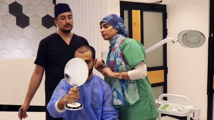 How we performed the Hair Transplant of Grade 7 baldness patient?