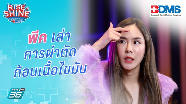 พีค เล่าการผ่าตัดก้อนเนื้อไขมัน | Rise & Shine ชีวิตดีเริ่มที่ตัวเรา ซีซั่น 4 EP.17 | 16 มี.ค. 67
