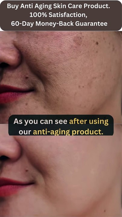 HOW CAN I REMOVE WRINKLES FROM MY FACE? | ANTI AGING SKINCARE | SKINCARE TIPS