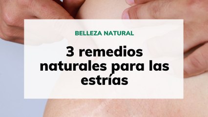 3 remedios naturales para las estrías