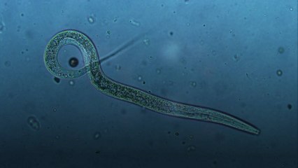 Chernobyl Worms Found to Have ‘Super Power’