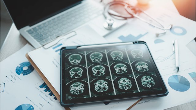 This man complained of painful migraines, his doctors discovered a parasite in his brain