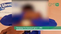 [#Reportage] Témoignage d’un défenseur des droits des LGBT agressé à Avea