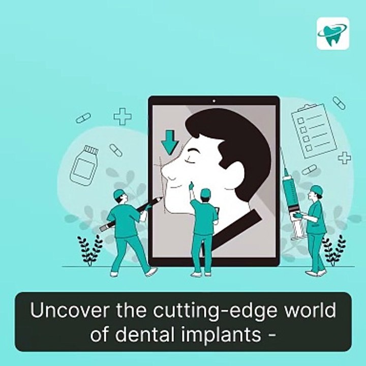 Exploring Budget-Friendly Dental Implant Options in Singapore