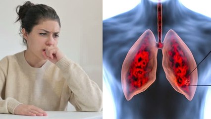 Télécharger la video: लंग्स इन्फेक्शन में क्या खाना चाहिए | Lungs Infection Me Kya Khana Chahiye Kya Nahi | Boldsky