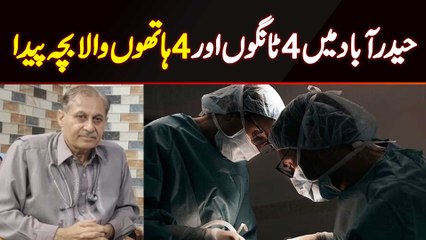 Hyderabad Mein 4 Legs or 4 Hands Wale Bache Ki Paidaish