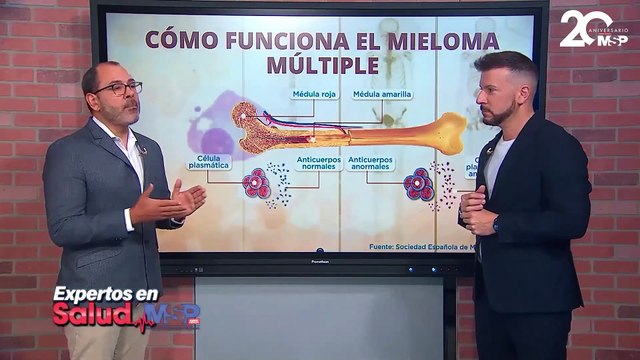 ¿Cómo funciona el mieloma múltiple o cáncer de células plasmáticas? - #ExclusivoMSP