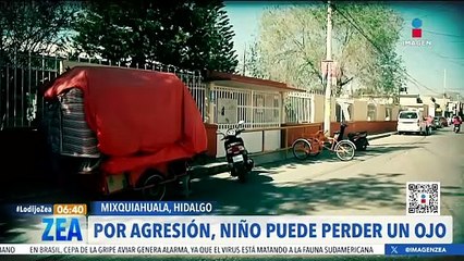 Niño fue agredido por compañero de clases y la escuela no le otorgó apoyo