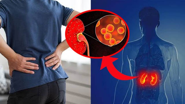 World Kidney Day 2024: किन लोगों को किडनी इन्फेक्शन से ज्यादा खतरा | Kidney Infection Symptoms