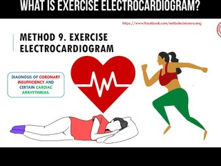 What is exercise electrocardiogram?