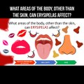 What areas of the body, other than the skin, can erysipelas affect?