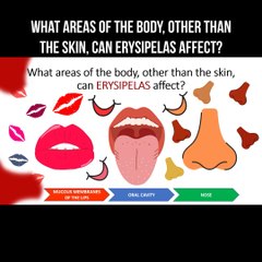 What areas of the body, other than the skin, can erysipelas affect?