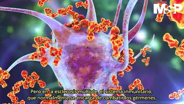 ¿Cómo funciona la esclerosis múltiple en el cerebro? - #EspecialMSP