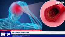 Derrames cerebrales: ¿Cómo identificarlos y actuar a tiempo? - #ExclusivoMSP