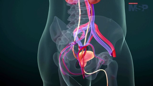 Alerta médica: La endometriosis se extiende a otros órganos - #ExclusivoMSP