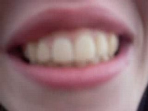 attente pour le concert de BB Brunes à Morlaix