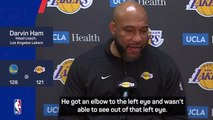Ham provides update on Davis eye injury after Lakers defeat
