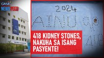 418 kidney stones, nakuha sa isang pasyente! | GMA Integrated Newsfeed